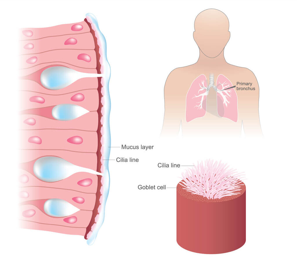 lung cancer cilia